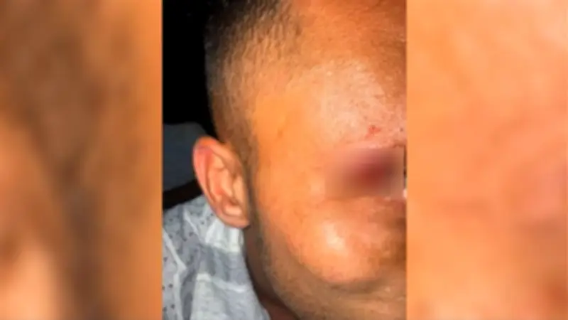 اعتداء على سياح إسرائيليين في كو ساموي: تفاصيل صادمة عن الهجوم والتداعيات