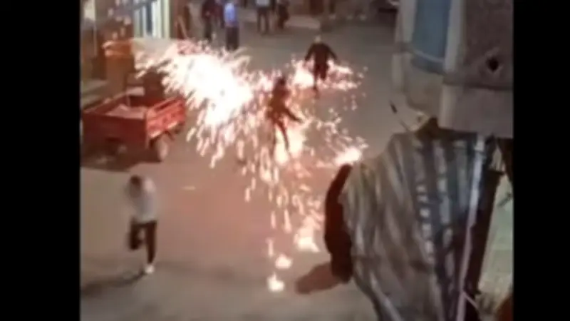 طفل يصاب بحروق خطيرة.. سلك المواعين المشتعل يثير الرعب وتحذيرات من كوارث محتملة