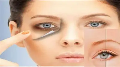 الهالات السوداء مع السهر والمذاكرة: حلول منزلية فعالة لاستعادة نضارة العينين