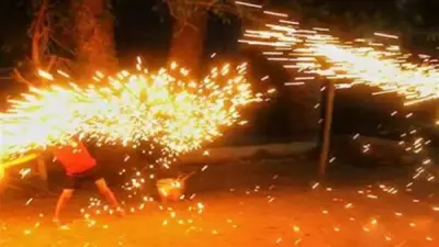 طفل في التاسعة يصاب بحروق خطيرة بعد إشعال سلك المواعين في منشأة ناصر