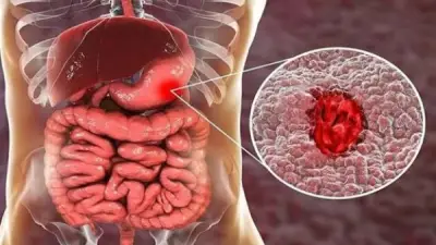 تأثير صيام رمضان على القولون: نصائح طبية لتجنب الاضطرابات الهضمية