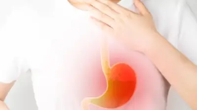 خبير يحذر: القطايف المقلية تسبب حرقة المعدة في رمضان.. نصائح لتجنبها