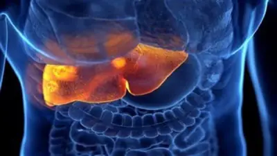 نصائح غذائية أساسية لمرضى الكبد الدهني خلال شهر رمضان المبارك