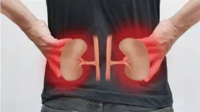 عميد معهد الكلى يقدم روشتة وقائية للحماية من أمراض الكلى والفشل الكلوي