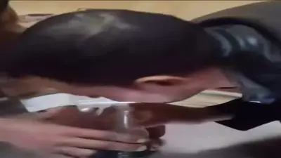 نقابة أطباء الأسنان بالبحيرة تحذر من علاج التسوس بالدخان وتؤكد خطورته