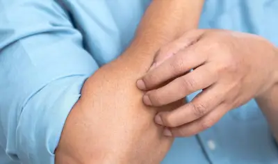احترس.. حكّة الجلد قد تكون مؤشرًا على تغيرات خطيرة داخل الجسم