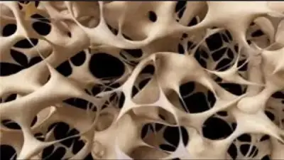 نصائح طبية فعالة لعلاج هشاشة العظام وتقوية الهيكل العظمي