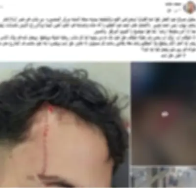 ضبط بلطجي المدارس بالدقهلية بعد تعديه بآلة حادة على زميله بسبب المزاح