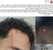 ضبط بلطجي المدارس بالدقهلية بعد تعديه بآلة حادة على زميله بسبب المزاح