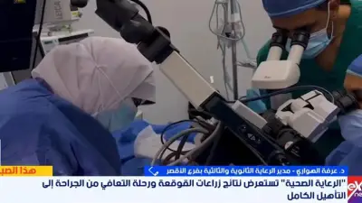 هيئة الرعاية الصحية تعلن: زراعة القوقعة في الأقصر بتكلفة رمزية لا تتجاوز 481 جنيهاً