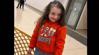 وزارة التعليم تتدخل لحل أزمة طفلة متلازمة داون بعد رفض مدارس الغربية قبولها