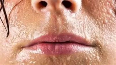 قناع طبيعي فعال لتقليل تعرق الوجه في الطقس الحار: وصفات سهلة التحضير