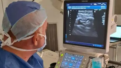 مستشفى بدر الجامعي ينهي معاناة نزيف مزمن لثلاث سنوات بتقنية القسطرة التداخلية