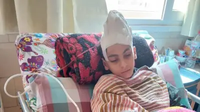 ضربة عصاية تودي بطفل إلى غرفة العمليات.. استغاثة تهز الإسكندرية بعد كسر جمجمة طفل