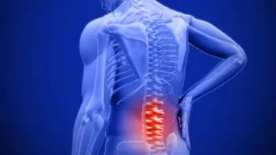 ألم العصعص: الأسباب الشائعة وطرق العلاج الفعالة للتخلص منه