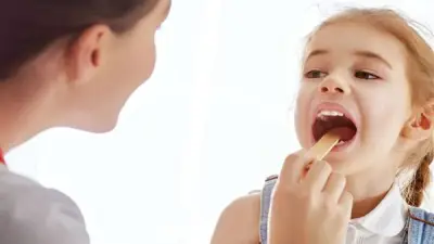 استشاري: إهمال التهاب اللوز قد يسبب أمراض القلب المزمنة