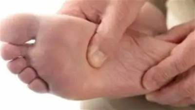 أسباب وأعراض القدم السكري وطرق علاجها المختلفة