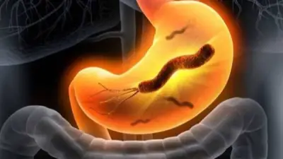 إهمال جرثومة المعدة قد يؤدي للسرطان: اكتشف الأسباب وعوامل الخطر الخطيرة