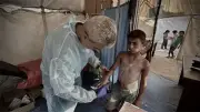 ارتفاع مقلق لإصابات جدري الماء بين أطفال غزة وسط تحذيرات من مضاعفات خطيرة