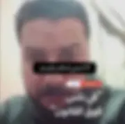 ادعاءات شخص بتعدي آخرين عليه وإصابته في الشرقية تثير الجدل