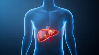 الوقاية من دهون الكبد: 3 نصائح أساسية تحميك من الإصابة