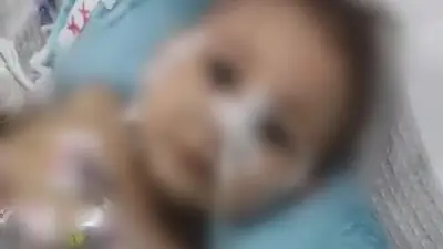 وفاة الطفلة رحمة بعد 3 أشهر من صراعها مع الموت إثر حقنها بالكلور