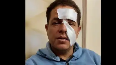 طالب يعتدي على معلم بسلاح أبيض في الدقهلية والتعليم تصدر 6 قرارات عاجلة