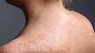 حالة تأهب قصوى في أمريكا تحسباً لانتشار 9 فيروسات معدية خلال كأس العالم