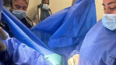إنجاز طبي بجامعة بنها.. استبدال الصمام المترالي بتقنية دقيقة دون فتح عظمة القص