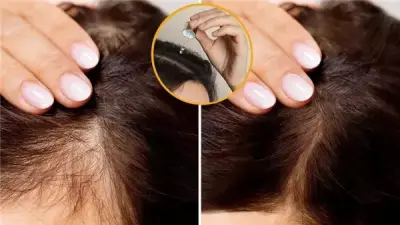 وصفة طبيعية لعلاج فراغات الشعر وزيادة كثافته