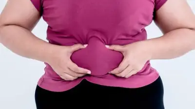 دهون البطن لا ترتبط بكثرة الطعام فقط.. أسباب خفية وراء الكرش