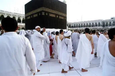 فتاوى الحج: حكم إزالة المحرم الزوائد الجلدية من جسد الحاج