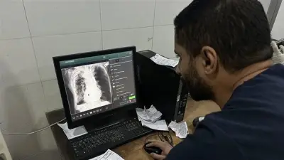 غياب أجهزة الرنين المغناطيسي في غزة.. أطباء بلا عيون ومرضى عالقون بين الحياة وحكم مؤجل بالموت