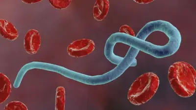 هل يتحول إيبولا إلى جائحة عالمية؟ خبير يوضح الحقائق