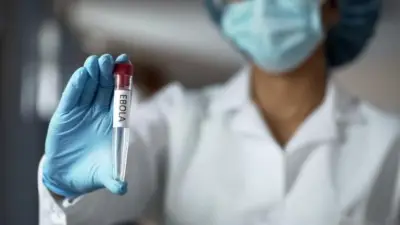 مصر تخلو من الإيبولا وإجراءات مشددة في المطارات لمواجهة الفيروس