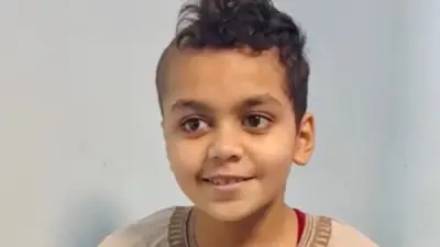مستشفى سوهاج الجامعي ينقذ طفلاً من نزيف حاد بالمخ بعد سقوطه من سيارة