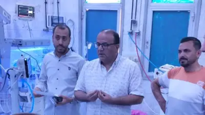 نجاح أول عملية تفتيت حصوات الكلى بالمنظار المرن والليزر بالمنوفية