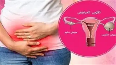 وزارة الصحة: تكيس المبايض يقلل فرص الحمل ويحتاج تشخيصا مبكرا