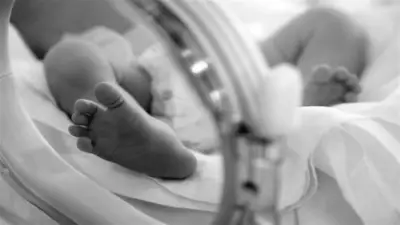 تقنية ECMO تنقذ حياة رضيعتين بعد توقف القلب لأكثر من 100 ساعة