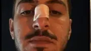 تعدي 15 شخصًا على شاب وكسر أنفه في زفة عروسين بوصلة دهشور