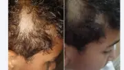 تعليم القاهرة تحقق في واقعة حلاقة شعر تلميذ بالطابور