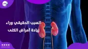 تلوث الهواء يهدد كليتيك: دراسة تكشف علاقة خطيرة