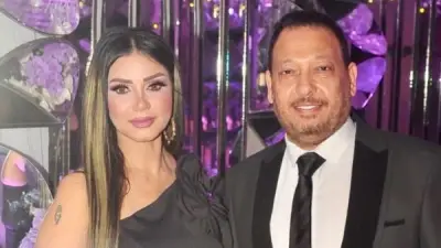 أحمد العيسوي يطمئن جمهوره بعد تركيب دعامتين بالقلب ويشكر نقيب الموسيقيين