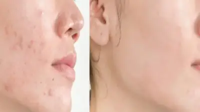 زيت السمسم: فوائد مذهلة للبشرة والشعر والأسنان وطرق الاستخدام