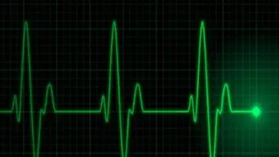 جهاز مبتكر لتنظيم نبضات القلب بالموجات فوق الصوتية دون جراحة