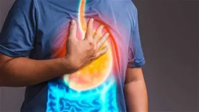 أكلات ممنوعة على مرضى ارتجاع المريء: تعرف عليها لتحسين صحتك