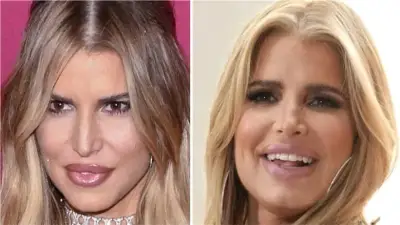 كارثة تجميلية: أخطاء شائعة في استخدام البوتوكس والفيلر تدمر مظهرك