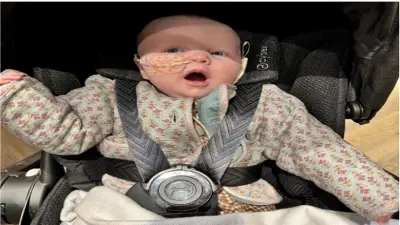 مرض نادر يمنع رضيعة بريطانية من الضحك ويجبرها على تركيب أنبوب تغذية