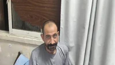 مريض بني سويف يحكي معاناته بعد استخراج 100 مسمار من معدته بالمنظار