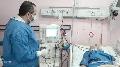 نجاح أول عملية فصل بلازما بمستشفى القناطر الخيرية في القليوبية